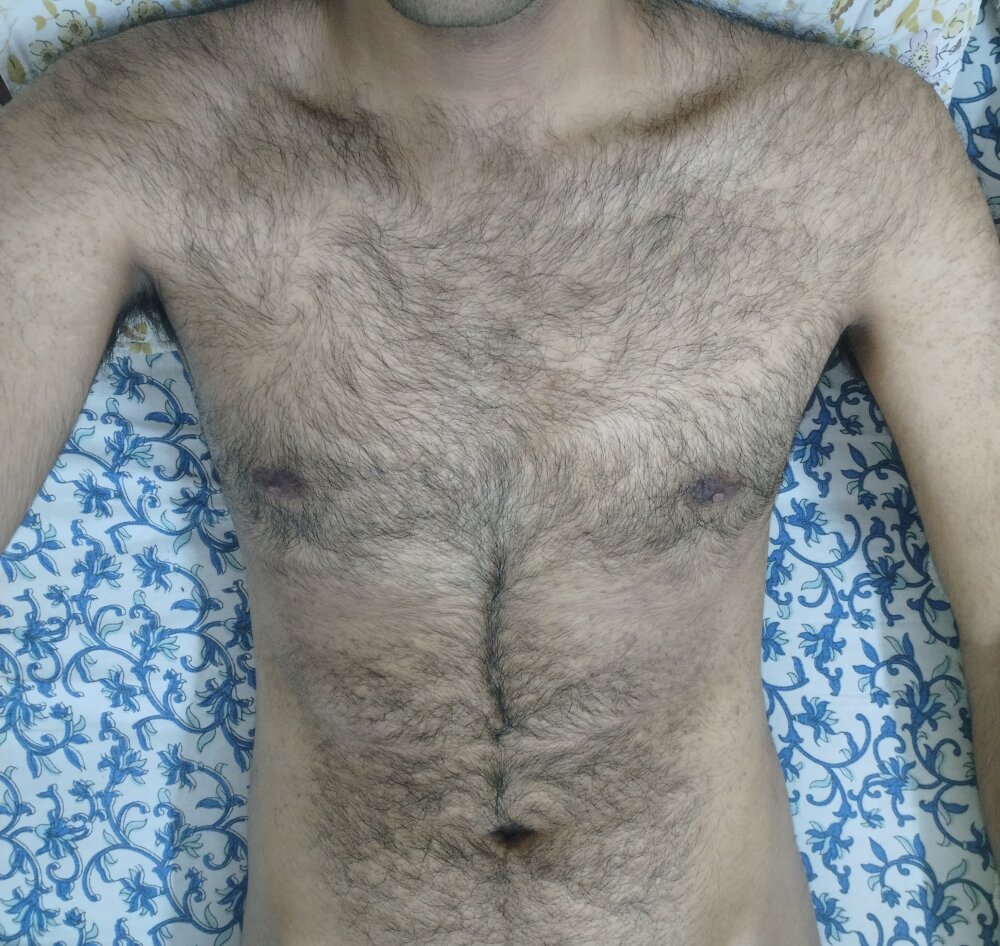slimbody